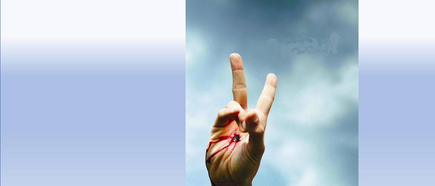 Das Foto zeigt eine Hand mit einer Schussverletzung. Aber die Finger formen das Victory-Zeichen.
