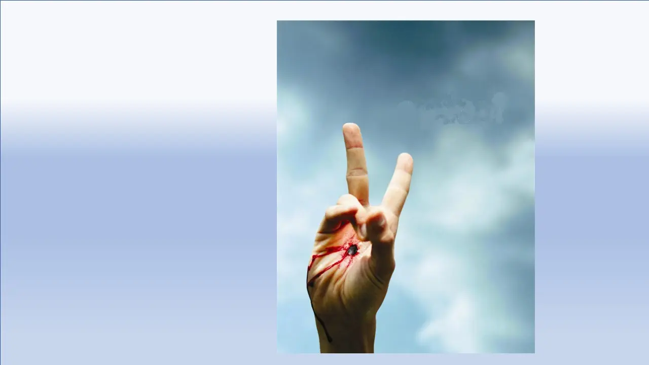 Das Foto zeigt eine Hand mit einer Schussverletzung. Aber die Finger formen das Victory-Zeichen.